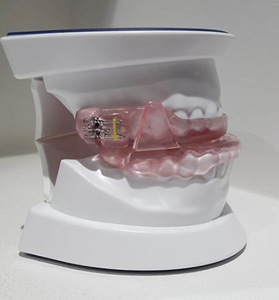 Dispositivo de avance mandibular para el tratamiento de pacientes RONCADORES o con SÍNDROME DE APNEA OBSTRUCTIVA DEL SUEÑO